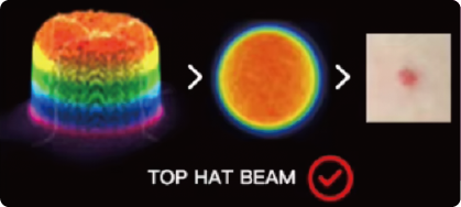 Machine Laser Detatouag