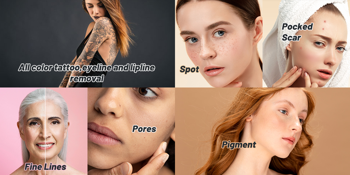 picosecond laser